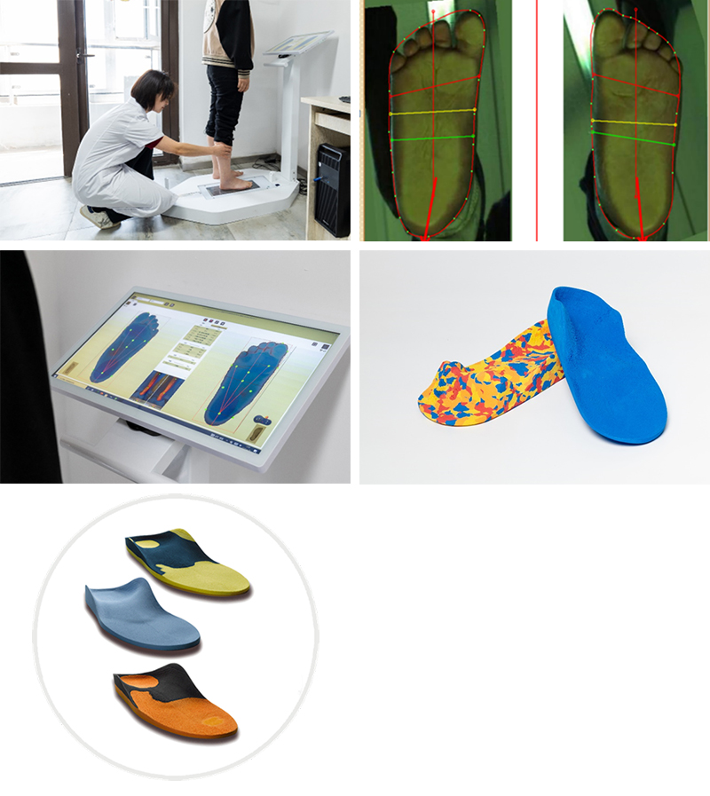 足底掃描---本體感受刺激鞋墊定制系統