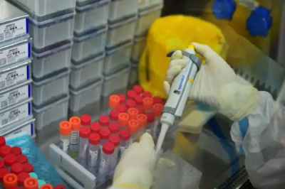 PCR实验室中使用核酸污染清除剂效果明显！